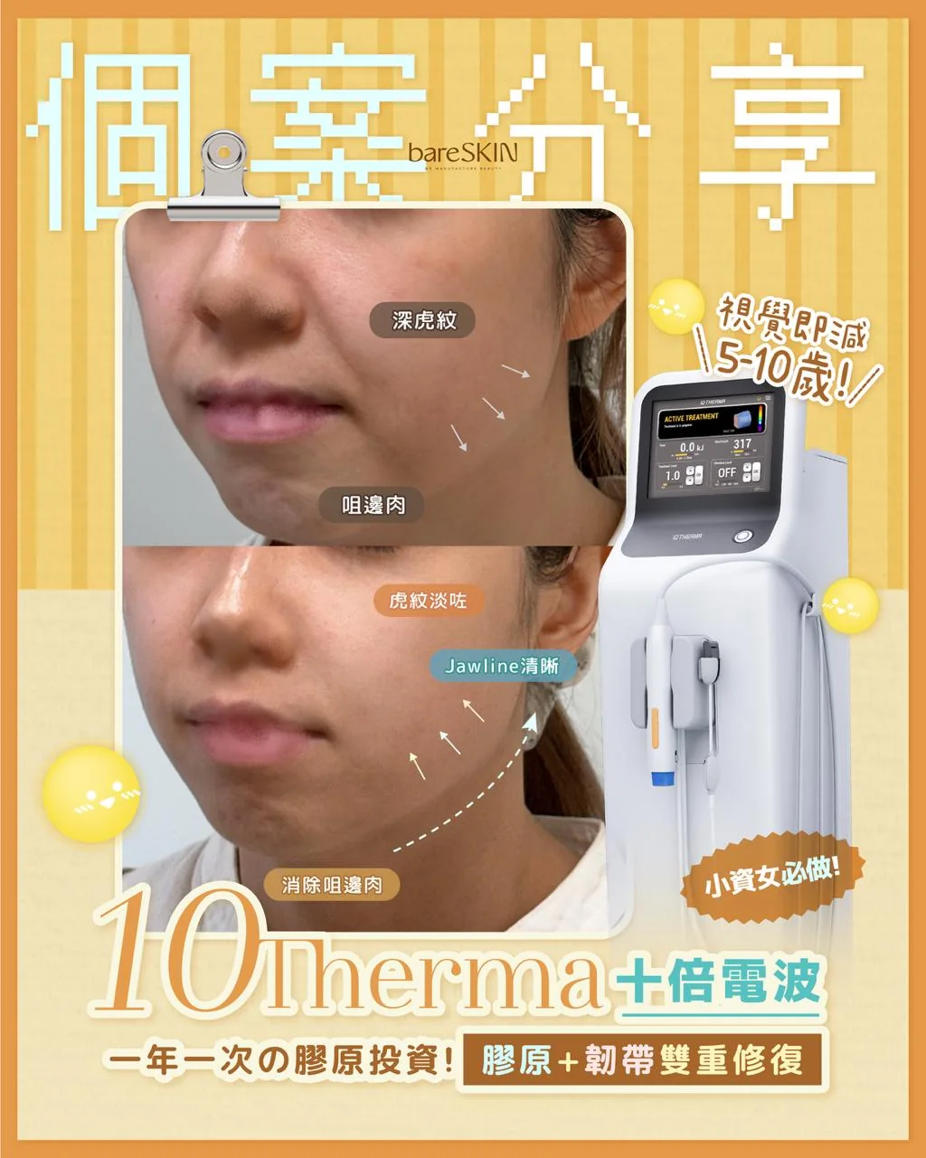 10THERMA真實客人分享7