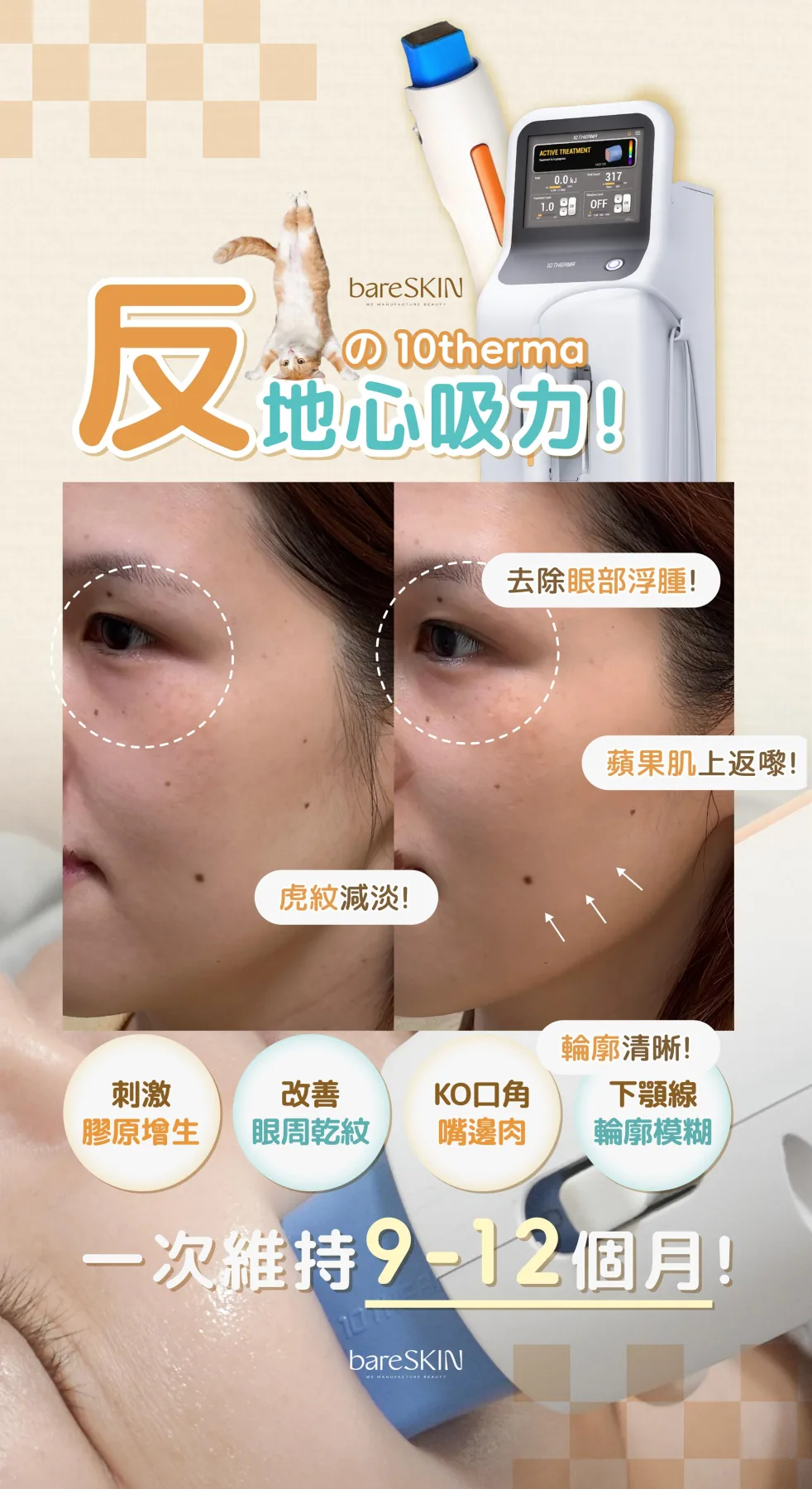 10THERMA真實客人分享9