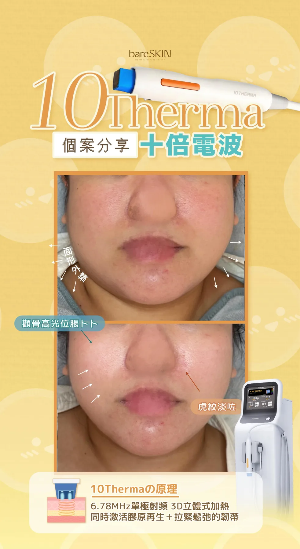 10THERMA真實客人分享10