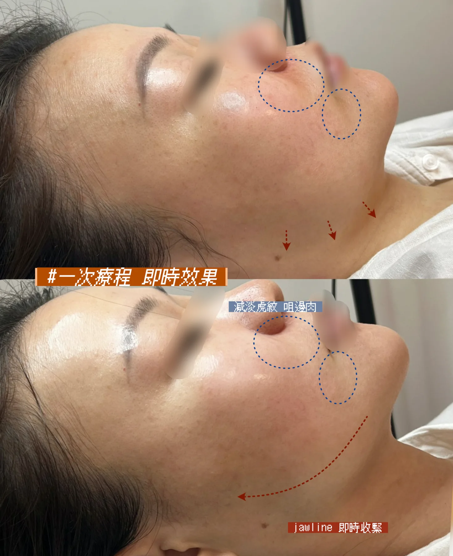 10THERMA真實客人分享4