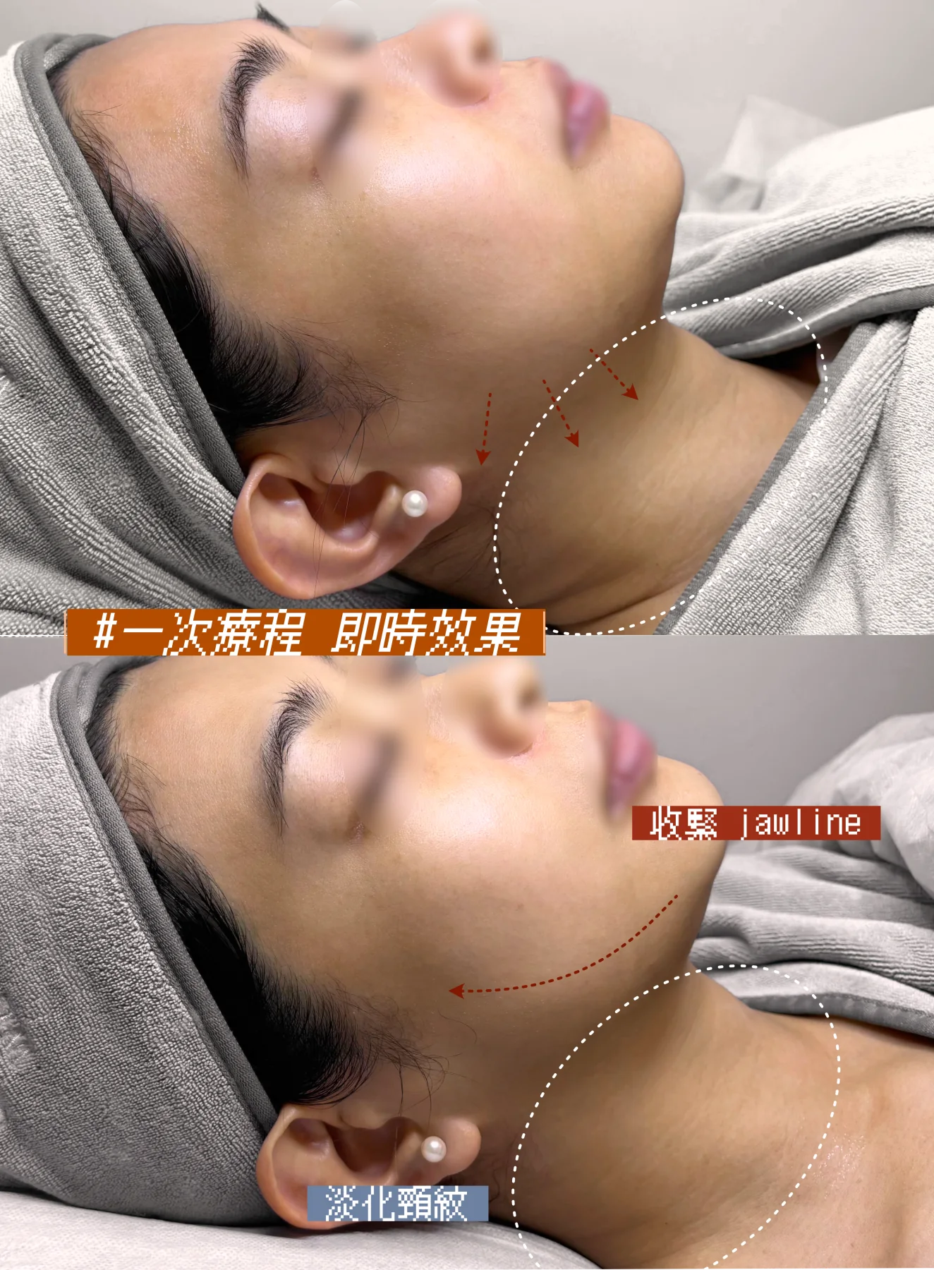 10THERMA真實客人分享2