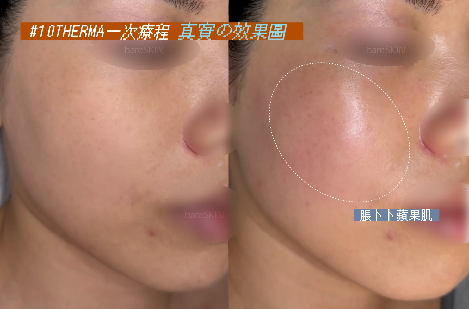 10THERMA真實客人分享3